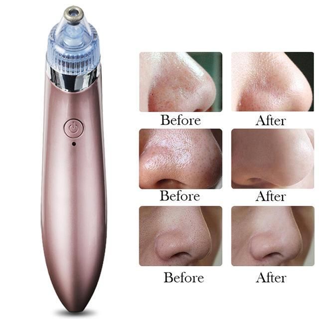 Blackhead Pore Vacuum Cleaner - Multifunctional Beauty Pore Vacuum 4 in 1